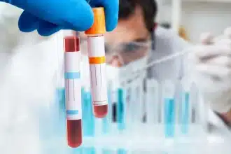 Sindrome da fatica cronica