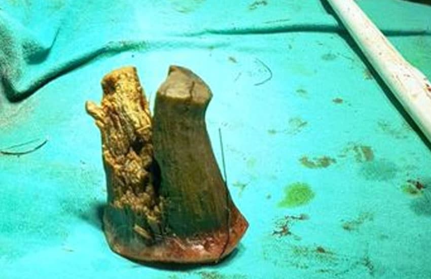 Shyam lal yadav: l'agricoltore indiano marchiato dal corno del diavolo -foto