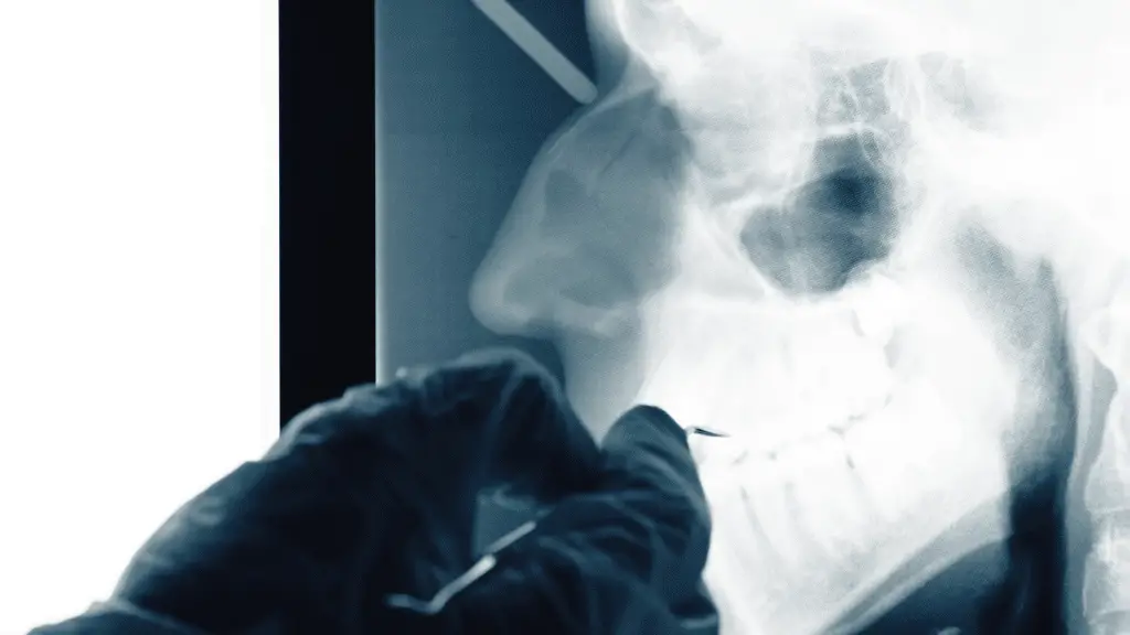 Il caso paracas spiegato senza fantasie: cosa rivelano davvero i teschi allungati %il caso paracas spiegato senza fantasie: cosa rivelano davvero i teschi allungaticount(title)% Paracas