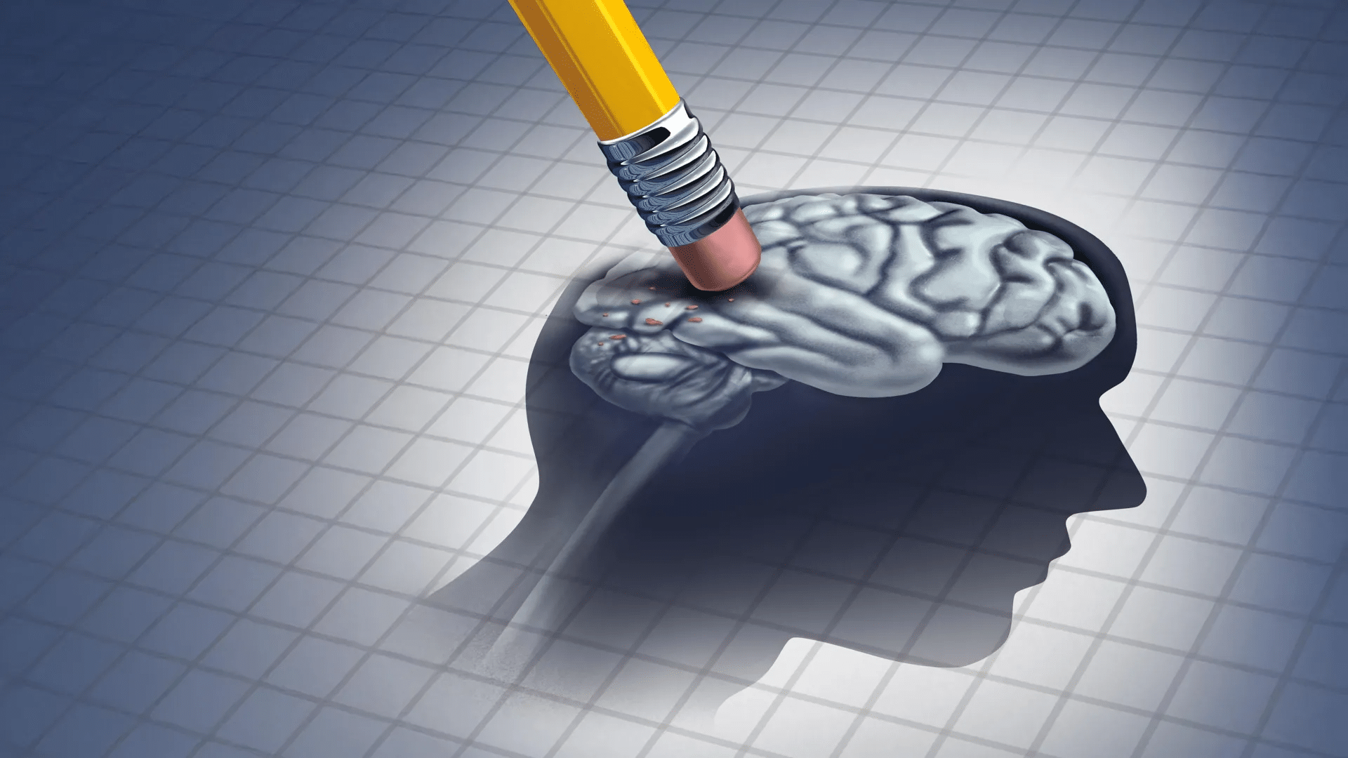 Alzheimer