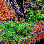 Scoperto il meccanismo immunitario che collega ibd e cancro del colon-retto %scoperto il meccanismo immunitario che collega ibd e cancro del colon-rettocount(title)% Scoperto il meccanismo immunitario che collega ibd e cancro del colon-retto