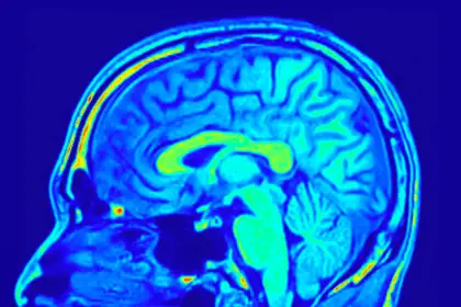 Depressione maggiore