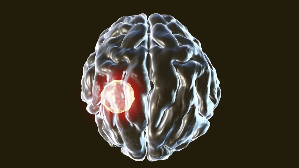 Un parassita può infettare le cellule che dovrebbero eliminarlo: scoperto un meccanismo chiave di difesa del cervello