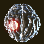 Un parassita può infettare le cellule che dovrebbero eliminarlo: scoperto un meccanismo chiave di difesa del cervello