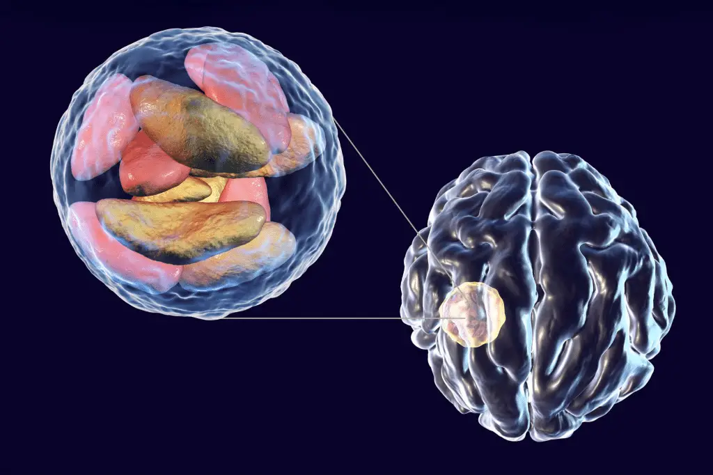 Un parassita può infettare le cellule che dovrebbero eliminarlo: scoperto un meccanismo chiave di difesa del cervello