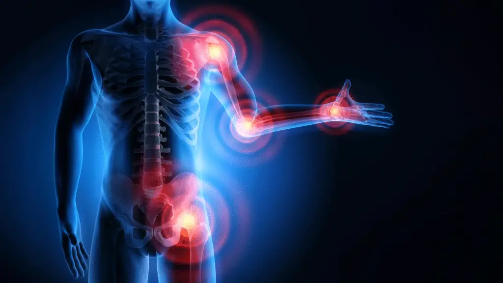 Scoperto il “freno biologico” dell’infiammazione: una nuova strada contro artrite e malattie cardiache %scoperto il “freno biologico” dell’infiammazione: una nuova strada contro artrite e malattie cardiachecount(title)% Scoperto il “freno biologico” dell’infiammazione: una nuova strada contro artrite e malattie cardiache