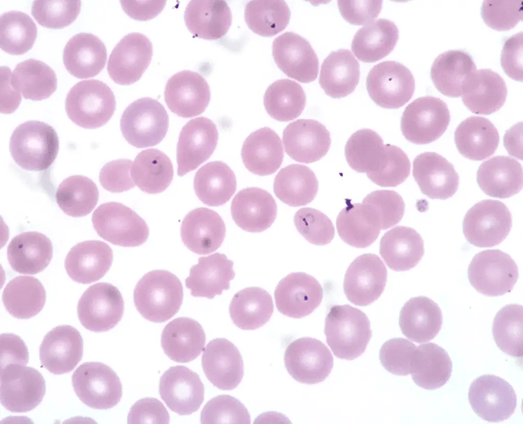 Malaria: scoperti cristalli “a propulsione” dentro il parassita: funzionano come micro-razzi %malaria: scoperti cristalli “a propulsione” dentro il parassita: funzionano come micro-razzicount(title)% Malaria: scoperti cristalli “a propulsione” dentro il parassita: funzionano come micro-razzi