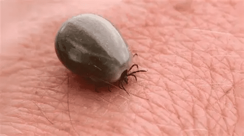 Sintomi di una puntura di zecca: non ignorare questa macchia, anche se non hai visto il parassita %sintomi di una puntura di zecca: non ignorare questa macchia, anche se non hai visto il parassitacount(title)% Sintomi di una puntura di zecca: non ignorare questa macchia, anche se non hai visto il parassita