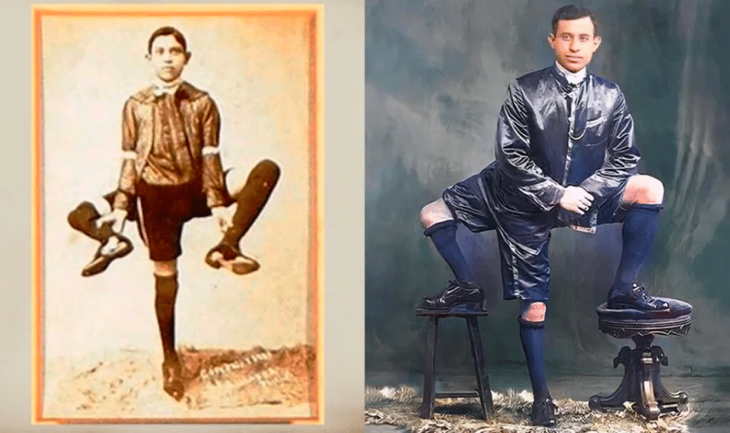 Frank lentini aveva 3 gambe? La storia del siciliano diventato famoso in america