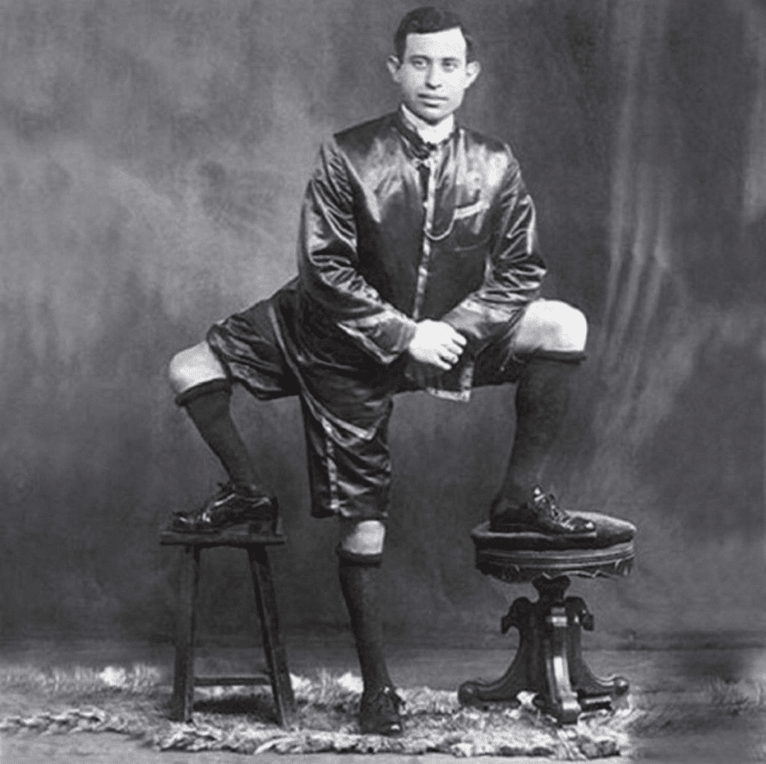 Frank lentini aveva 3 gambe? La storia del siciliano diventato famoso in america