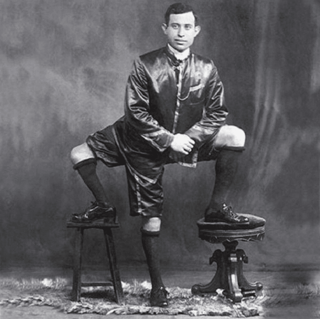 Frank lentini aveva 3 gambe? La storia del siciliano diventato famoso in america