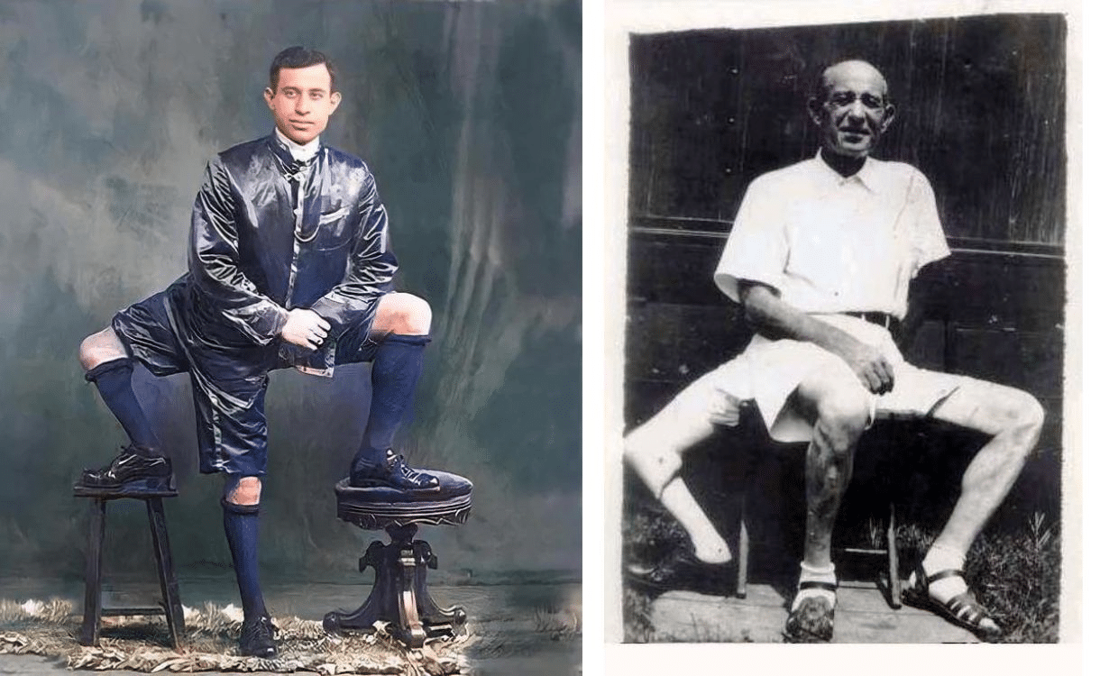 Frank lentini aveva 3 gambe? La storia del siciliano diventato famoso in america