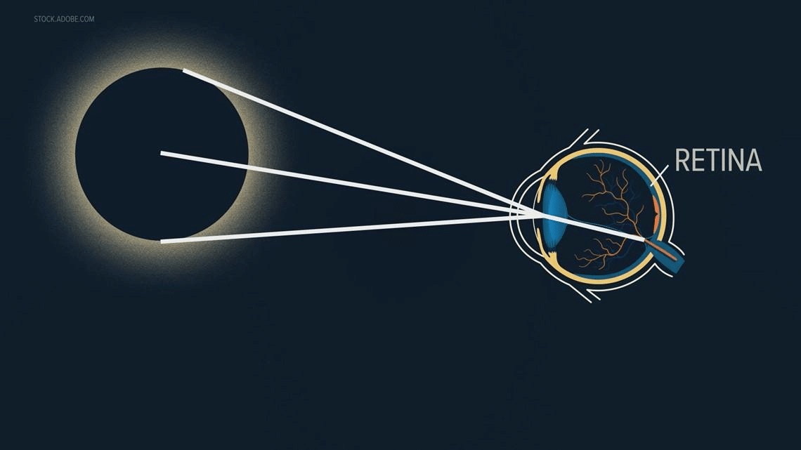 Hai guardato l’eclissi e ti fanno male gli occhi? Come capire se hai danneggiato la retina %hai guardato l’eclissi e ti fanno male gli occhi? Come capire se hai danneggiato la retinacount(title)% Hai guardato l’eclissi e ti fanno male gli occhi? Come capire se hai danneggiato la retina