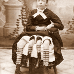 Myrtle corbin aveva 4 gambe? La sua storia e le foto vere