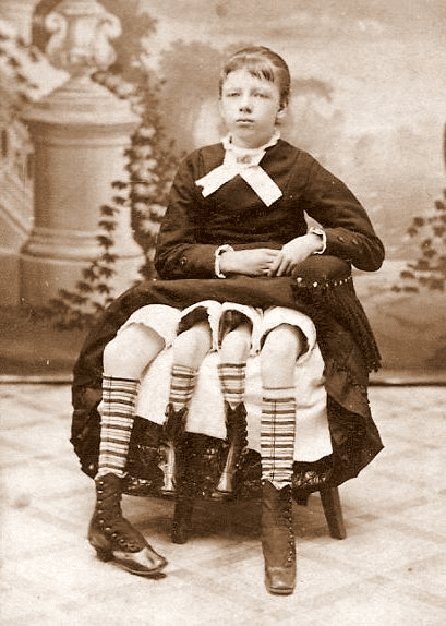 Myrtle corbin aveva 4 gambe? La sua storia e le foto vere