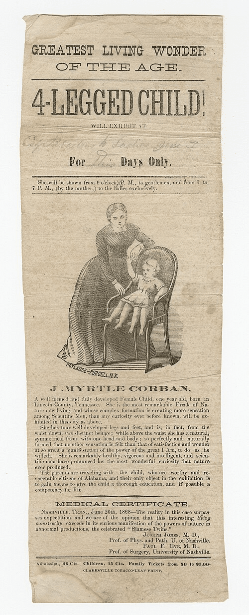 Myrtle corbin aveva 4 gambe? La sua storia e le foto vere
