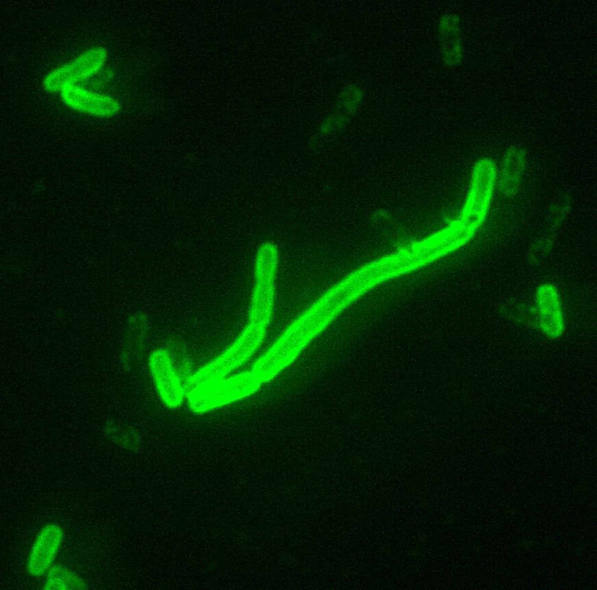 Peste polmonare in russia, il caso irkutsk: cosa sappiamo e quali sono i rischi %peste polmonare in russia, il caso irkutsk: cosa sappiamo e quali sono i rischicount(title)% Yersinia pestis, batterio responsabile della peste
